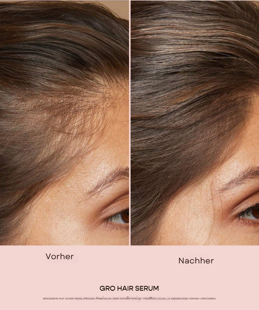 Vegamour® - GRO Haarserum